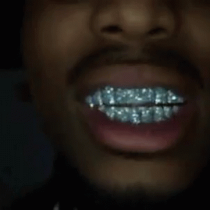 black diamond grill teeth