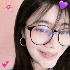 Braces Gifs 7 Braces Gifs 7