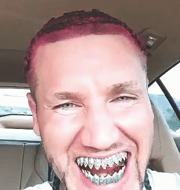 Image result for ugliest grillz animated gif
