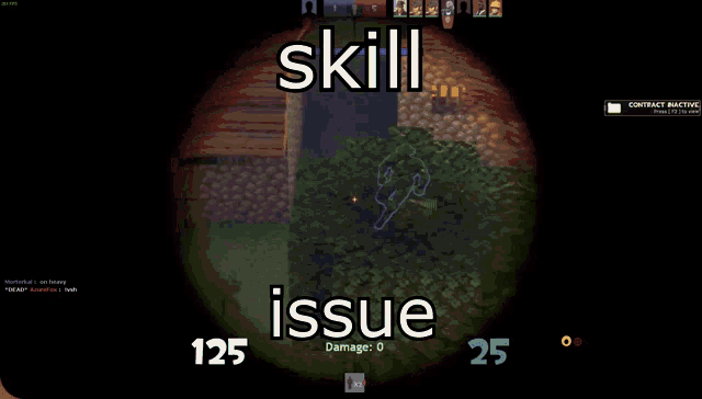 a screenshot of a video game with the words skill issue at the top