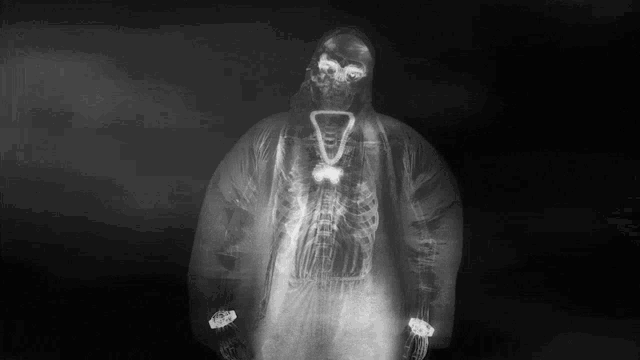 a black and white photo of a person with a skeleton on their back