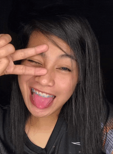 a girl with braces on her teeth is making a peace sign with her tongue out