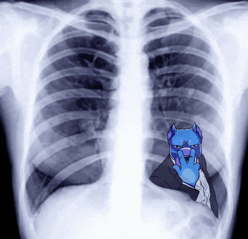 an x-ray of a person 's chest with a blue dog in a suit on it