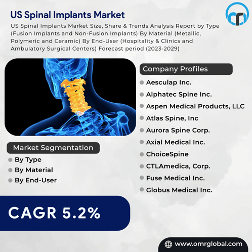 Us Spinal Implants Market GIF - Us Spinal Implants Market GIFs