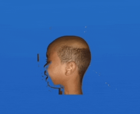 a close up of a person 's head with a shaved head