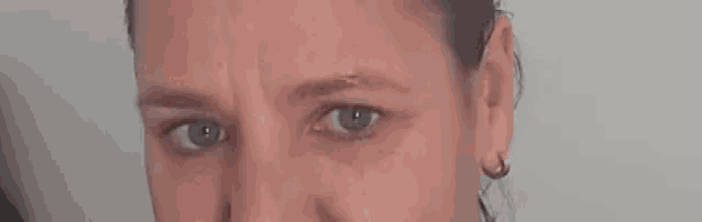 a close up of a woman 's face with a bruise on her eyebrow .