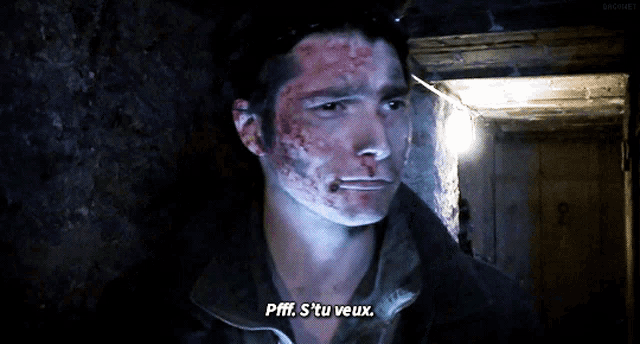 a man with blood on his face says " pfft s 'tu veux "