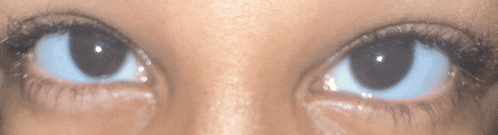 a close up of a person 's eyes with a slight curve