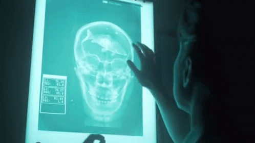 Skull X Ray Kasabian GIF - Skull X Ray Kasabian Youre In Love With A Psycho GIFs
