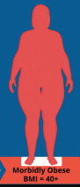a red silhouette of a person with morbidly obese bmi