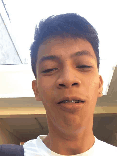 a young man with braces on his teeth making a funny face