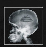 an x-ray of a human skull with a pile of poop in the middle of it .