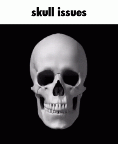 Skull Issues Skill Issues GIF - Skull Issues Skill Issues Bruh Hell Naw GIFs