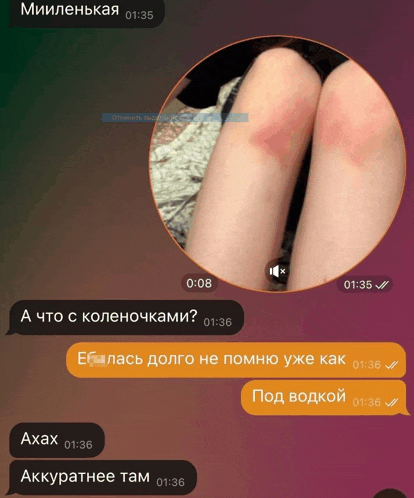 a screenshot of a text message with a picture of a woman 's knee
