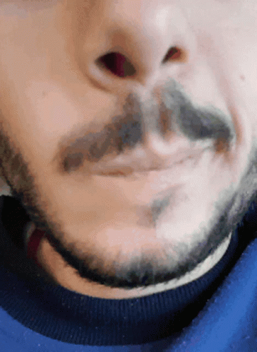 Nosej Twitching GIF - Nosej Twitching Mustache GIFs