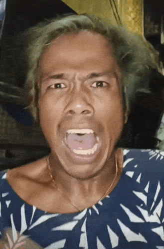 a man with green hair making a funny face with his mouth open
