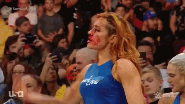 a woman with blood on her face is wearing a blue shirt that says live