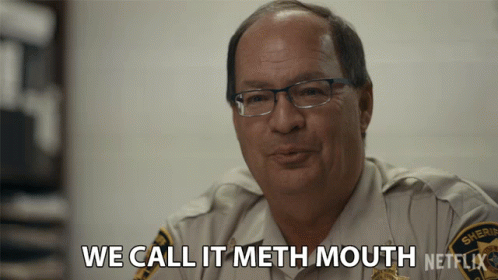 We Call It Meth Mouth No Teeth GIF - We Call It Meth Mouth No Teeth Drug Use GIFs