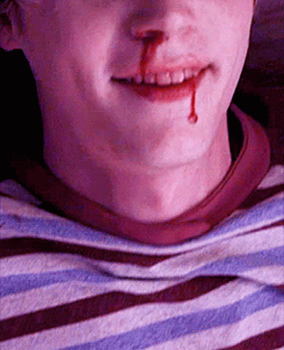 Evan Peters Bleeding GIF - Evan Peters Bleeding Thousandeyes GIFs