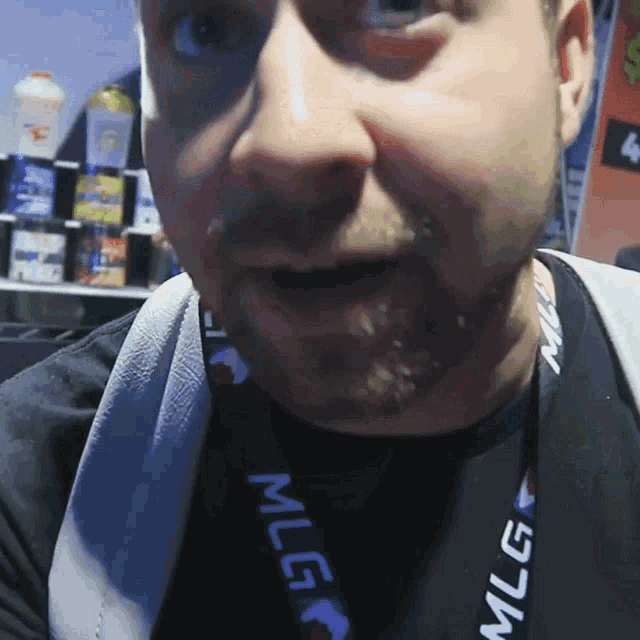 a man wearing a lanyard with the word mlg on it