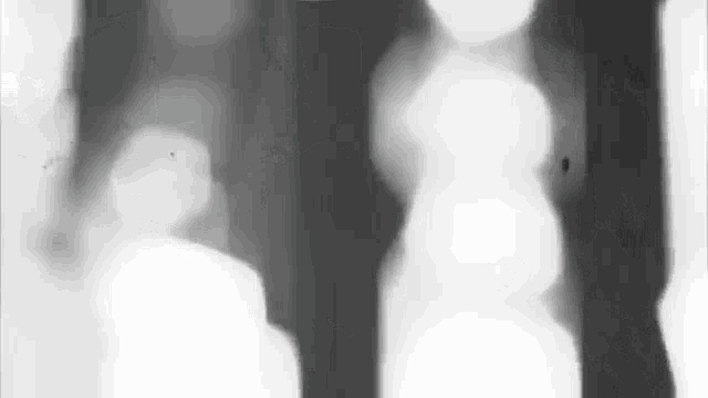 a black and white x-ray of a person 's knee and ankle .