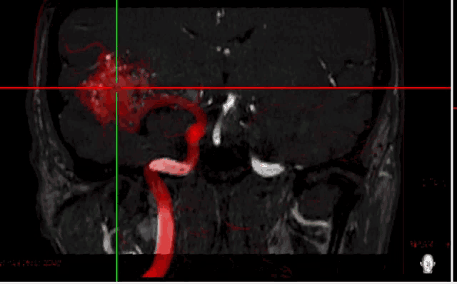 a black and red image of a person 's head with a green line