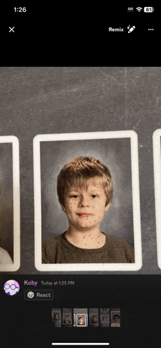 a phone screen shows a picture of a young boy with red spots on his face and says koby today at 1:25 pm