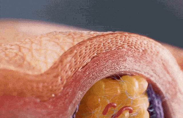 a close up of a blood vessel with a yellow object in it