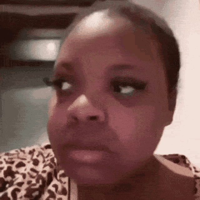 a woman with a black eye is making a funny face with her eyes closed .