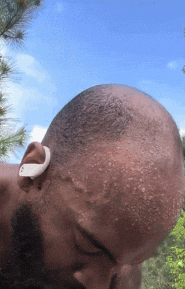a close up of a man 's head with sweat on it and a blue sky in the background