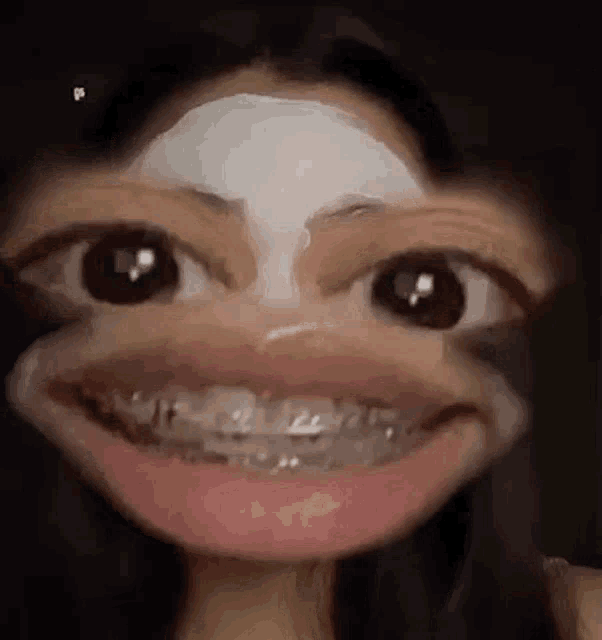 a woman with braces on her teeth is making a funny face with a mask on her face .