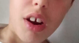 Morreu Teeth GIF - Morreu Teeth Tongue Out GIFs