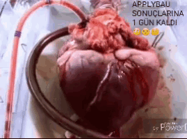 a close up of a heart with a hose attached to it .