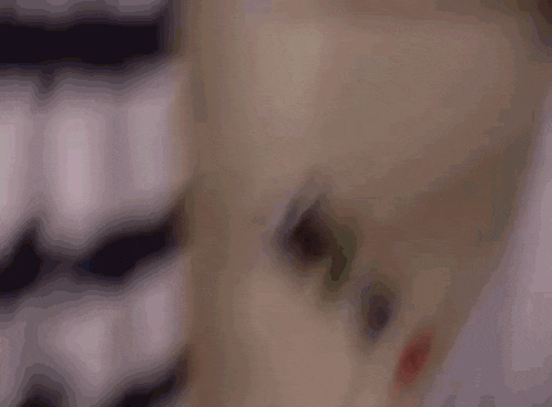 a blurry picture of a person 's arm with a broken heart in the background .