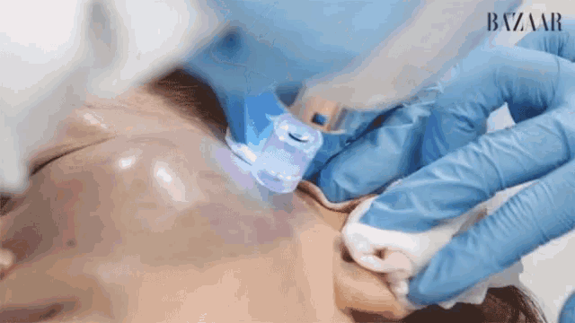 a woman is getting a laser treatment on her face while wearing blue gloves .