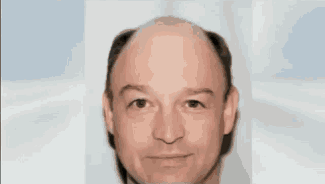Hair Club Hair Restoration GIF