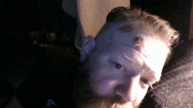 a man with a bruise on his forehead is looking at the camera