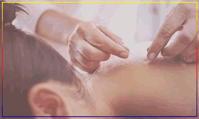 a woman is getting acupuncture treatment on her back