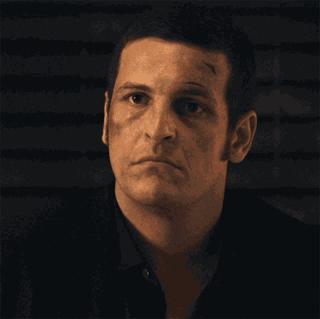 a man with a black shirt on has a bruise on his forehead