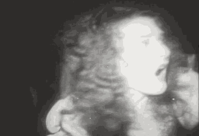 a black and white photo of a woman with her mouth open .