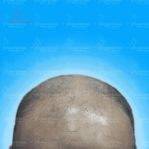 a picture of a man 's head with a blue background with arabic writing