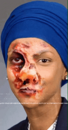 Zombie Ilhan Scary GIF - Zombie Ilhan Scary Wounds GIFs