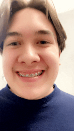 a man with braces on his teeth smiles for the camera