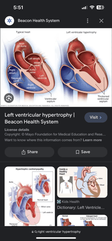 Heart Heart System GIF - Heart Heart System Heart Images GIFs
