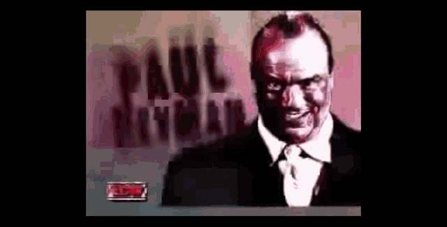a man with blood on his face is wearing a suit and tie and smiling .