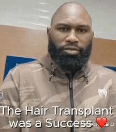 a bald man with a beard is wearing a jacket with the words " the hair transplant was a success " on it