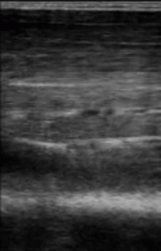 Ultrasound Muscle GIF - Ultrasound Muscle Biceps GIFs
