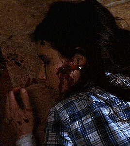 a woman in a plaid shirt with blood on her face
