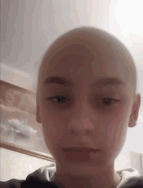 a close up of a boy 's face with a very bald head