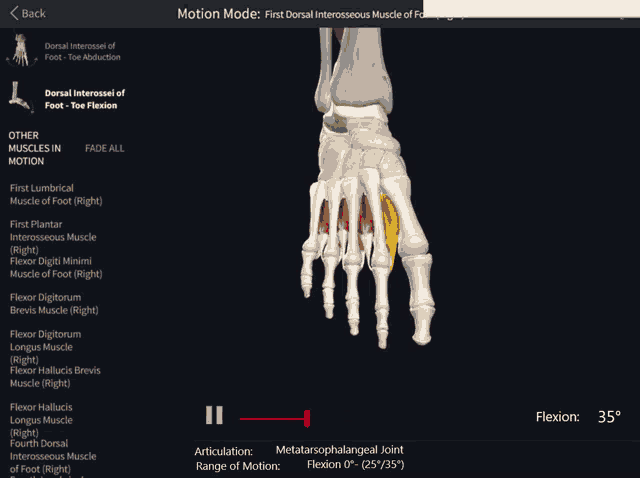 a computer screen shows a skeleton of a foot and says " motion mode " at the top